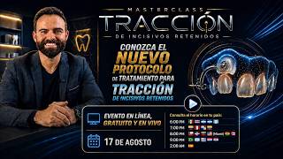 Masterclass | Nuevo Protocolo de Tracción de Incisivos Retenidos | Dr. Sérgio Cury