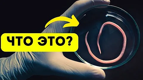 Вы обязательно должны знать об этих ПАРАЗИТАХ #паразиты #глисты