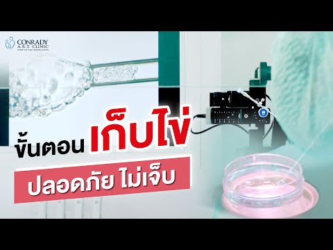 ขั้นตอนการเก็บไข่ ในการทำเด็กหลอดแก้ว | 𝐈𝐕𝐅 𝐂𝐨𝐧𝐫𝐚𝐝𝐲