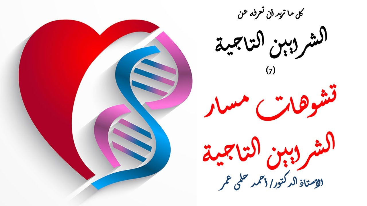سلسلة كل ما تريد أن تعرفه عن الشريان التاجى (7) - تشوهات مسار الشريان التاجىى