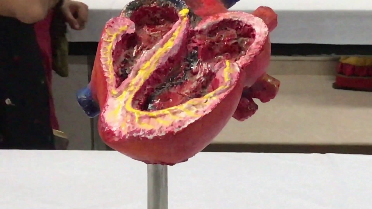 CONDUCTION SYSTEM HEART Medex 2017 : Medical Lectures upsc lectureship
