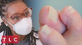 Patient S Right Foot Is 3x Bigger Than Her Left My Feet Are Killing Me Youtube Patient S Right Foot Is 3x Bigger Than Her Left My Feet Are Killing Me Youtube