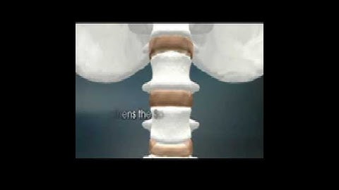 Teeter Hang Ups Inversion Table