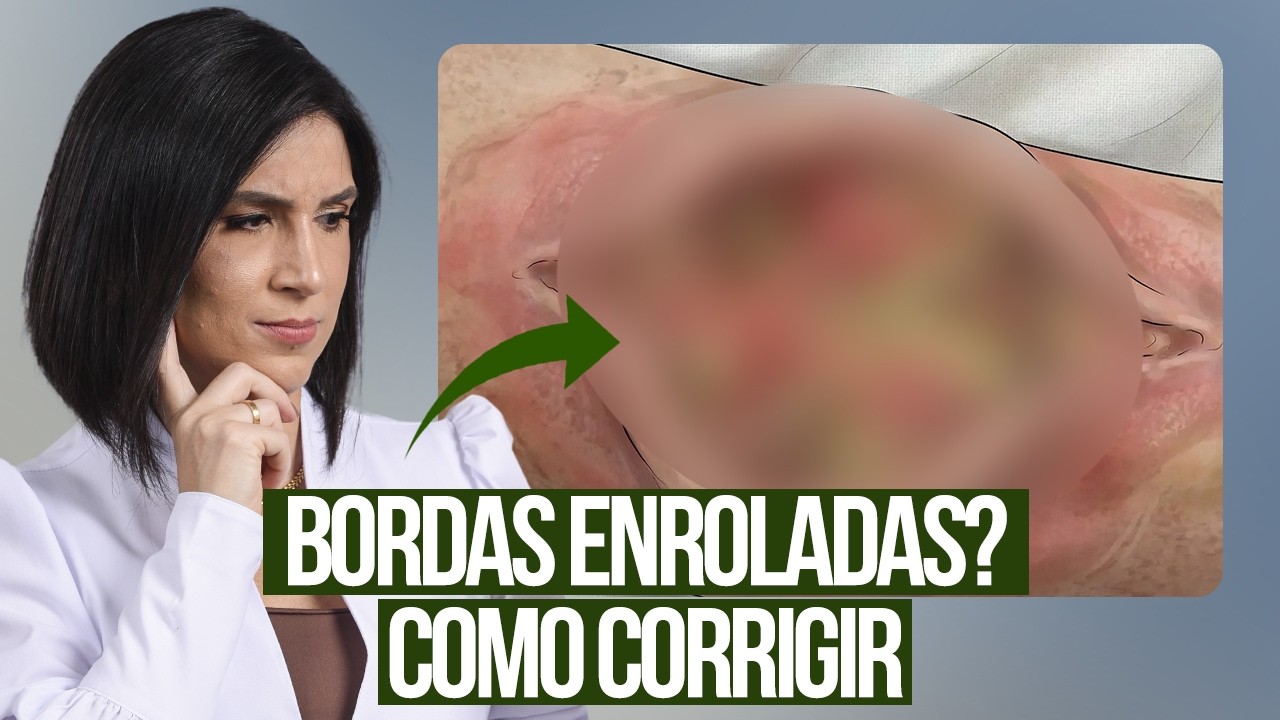 Como TRATAR Bordas com Epíbole - YouTube