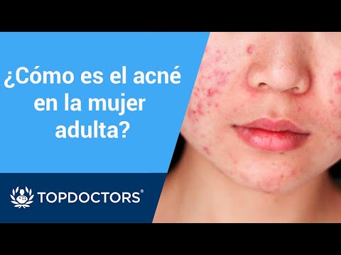 ¿Cómo es el acné en la mujer adulta? - Dr. Pablo de la Cueva (2/4)