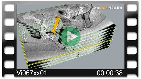 DynaMesh® MRI - Animation: MRI Reconstruction with DynaMesh®-PRS visible