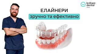 Процес лікування елайнерами в стоматологічній клініці Brillant Dental