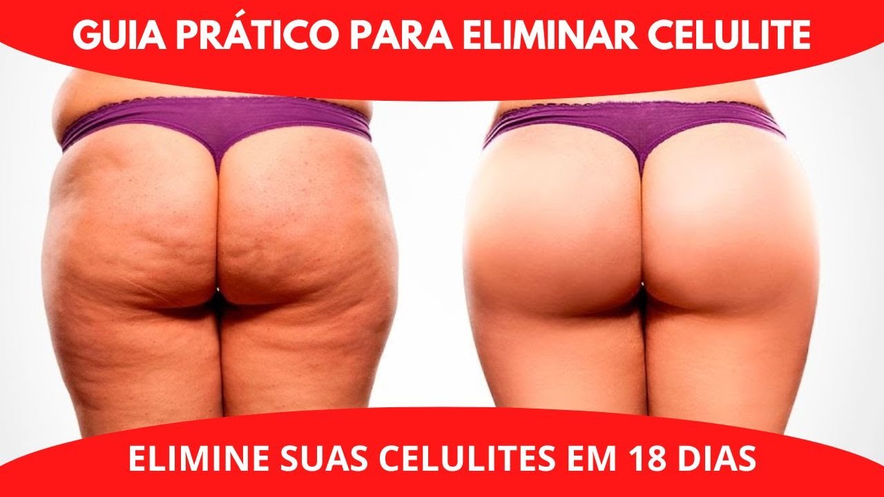 GUIA PRÁTICO PARA ELIMINAR CELULITES EM 18 DIAS - YouTube