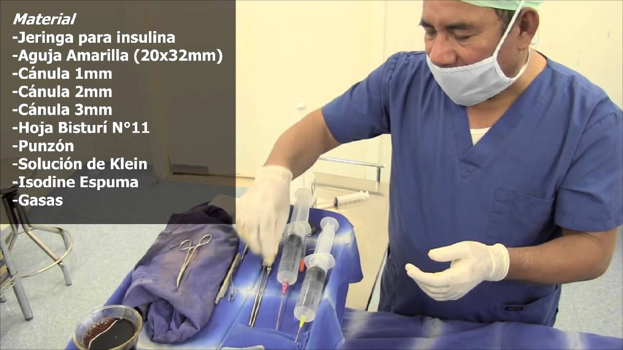 Se Puede Operar El Pecho Con Anestesia Local Liposuccion Con Anestesia Local - LOCLAGE