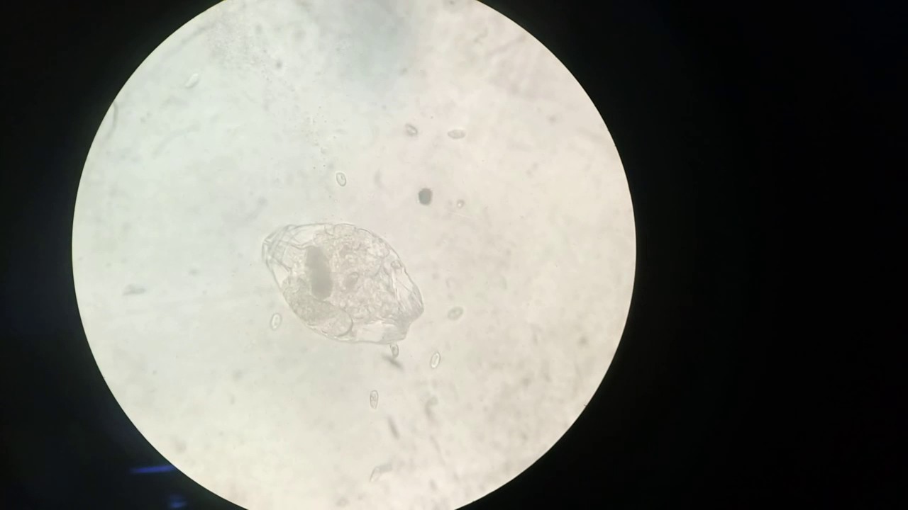 Rotifer movement