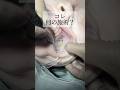 【小顔整形】コレ何の施術?#shorts