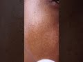 DRY SKIN Expert Shares Top Tips for FLAWLESS Skin!