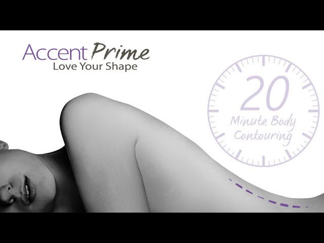 Alma Accent - Your New Life Lines