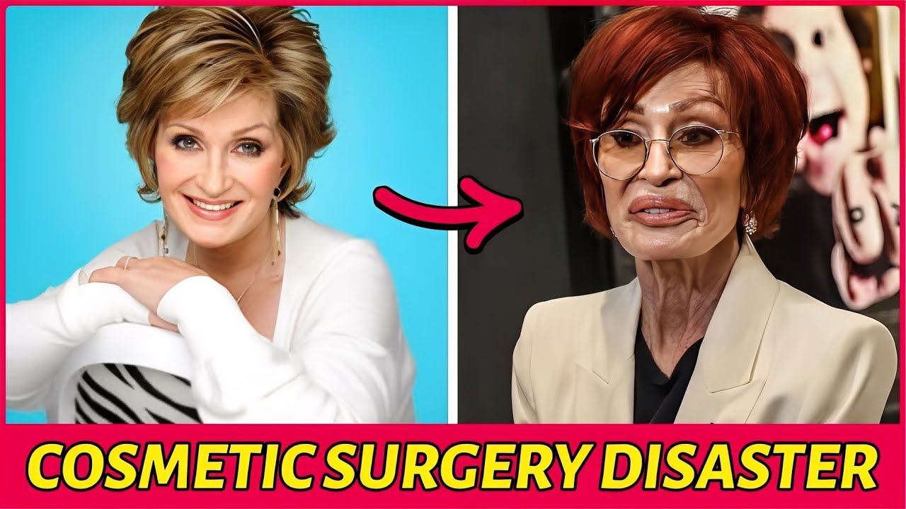50 Stars Who Completely Ruined Their Faces With Plastic Surgery Disasters
