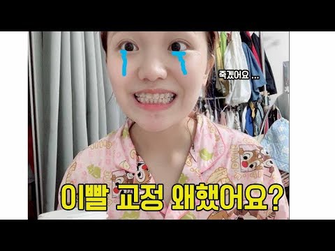 교정기 왜했는지 주절주절 설명했습니다 (이유? 발치? 통증?)