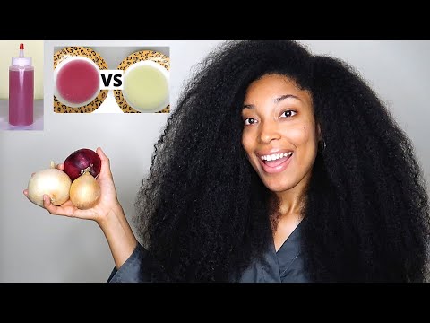 How To Use Onion Juice for EXTREME HAIR GROWTH | Differences between Red and Brown Onions