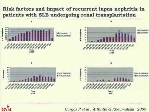 Χρόνια Νεφρική Νόσος (ΧΝΝ) - Η Χρόνια Νεφρική Νόσος στα Νοσήματα του Συνδετικού Ιστού