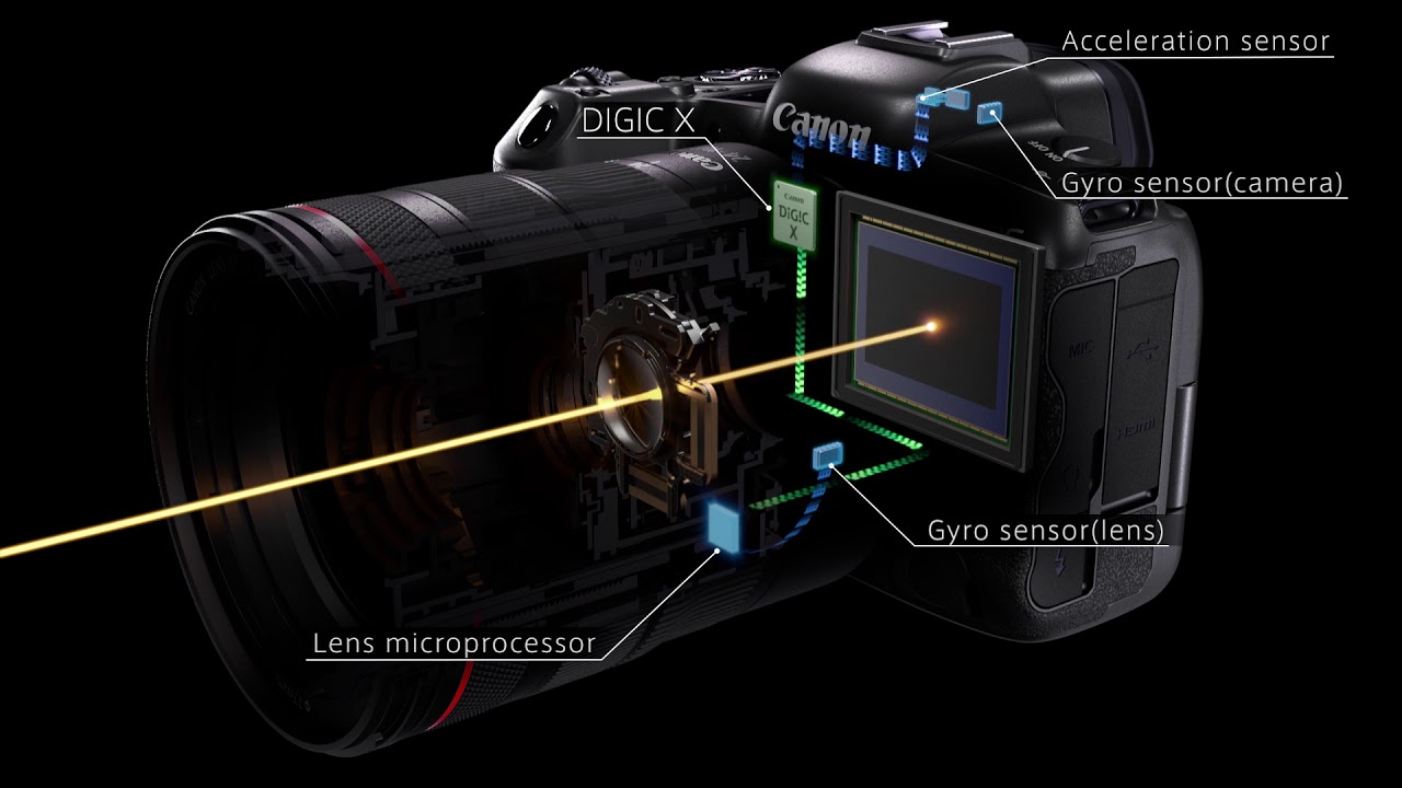 camera hiperbara anti imbatranire)