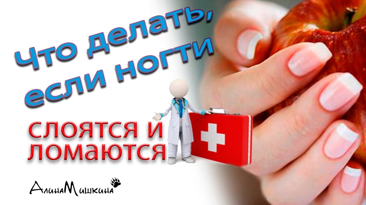 Если у вас слоятся ногти: что делать и как их лечить Если у вас слоятся ногти: что делать и как их лечить