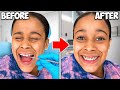 Girl GOES TO THE DENTIST, Finally GETS BRACES