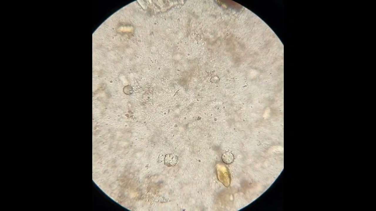 GSE: Undigested food, fatty bodies, and starch