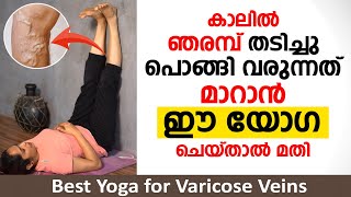 കാലിൽ ഞരമ്പ് തടിച്ചു പൊങ്ങി വരുന്നത് മാറാൻ ഈ യോഗ ചെയ്താൽ മതി | Yoga for varicose veins