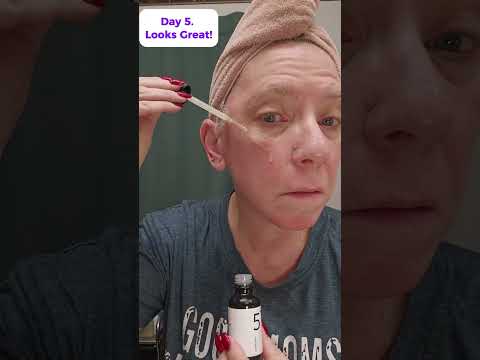 Weekly Skin Transformation With Numbuzin No 5 Serum 