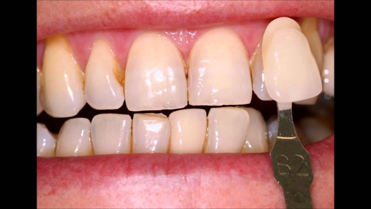 Austin cosmetic dentistry YouTube