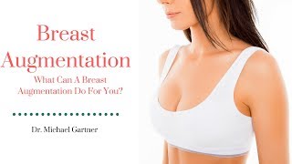 What Can A Breast Augmentation Do For You? | Dr. Michael Gartner