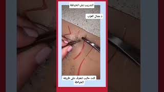 Learn How to Stitch Wounds for Beginnersعلم خياطة الجروح للمبتدئين