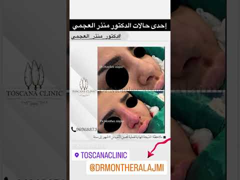 دكتور منذر العجمي إستشاري أنف وأذن وحنجرة وتجميل وجه ورقبة  تجميل ترند