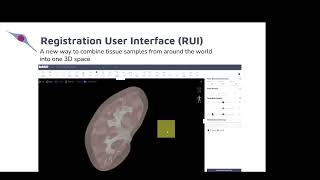 Mapping the Human Body at Single-Cell Resolution: Developing the Human Reference Atlas