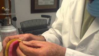 Prosthodontist's Secret to Setting Denture Teeth