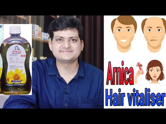 बालों को झड़ने के लिए तेल, Bekson Sunny Hair Oil for dandruff , Hair_loss  oil - YouTube