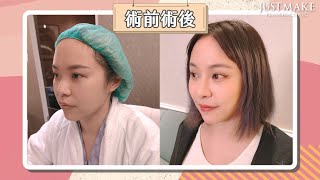 開水小姐開始喜歡上這樣的自己-素人案例分享-嘉仕美整形外科診所