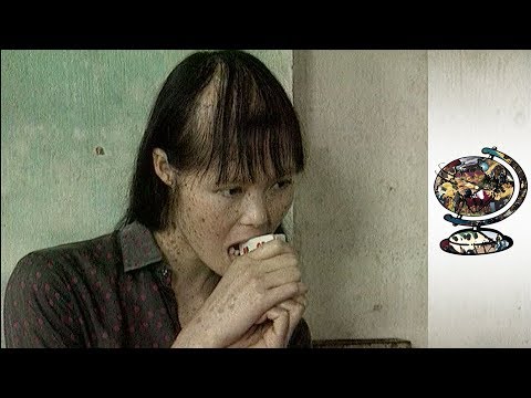 Agent Orange Vietnam War Side Effects