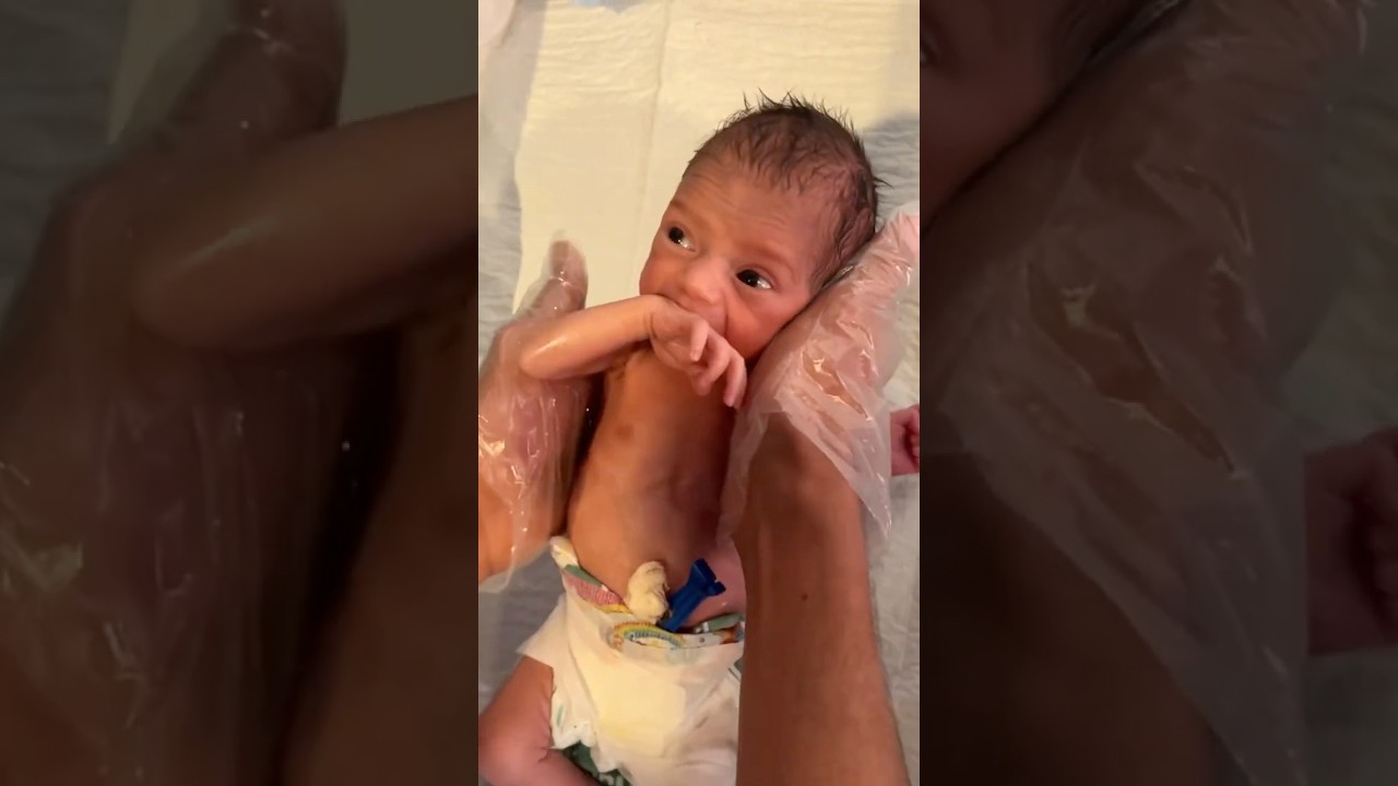 Physiotherapy for Cute Baby 👶🩺 | Gentle Healing Care