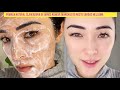 POMADA NATURAL DE ARROZ PARA REMOVER MANCHAS DO ROSTO SARDAS MELASMA MANCHAS DE ACNE