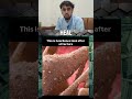 how bone heal after a fracture #informative #medicalscience #america