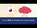 Reduce Your Stroke Risk: Exercise & Don't Smoke