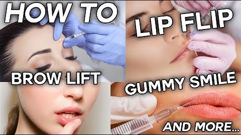 How To Inject Botox - Frown, Forehead, Brow Lift, Gummy Smile, and Lip Flip
