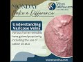 The Reality Of Castor Oil For Varicose Veins