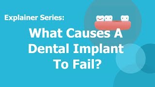 What Causes A Dental Implant To Fail? | LA Dental Clinic