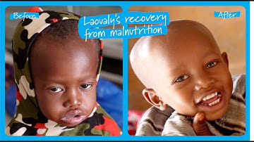 Laoualy’s recovery from severe malnutrition in Niger | UNICEF