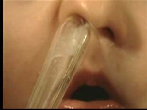 пост. стекающие сопли. стекающие сопли. постринальный синдром. слюна без фона.