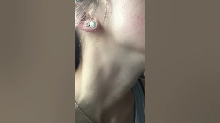 Johnson’s regional assessment #4 up close jugular pulsation