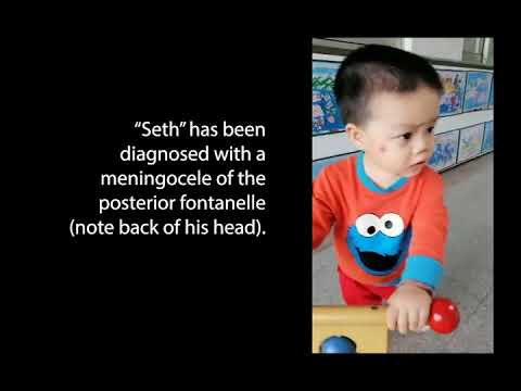 mission trips in the us Seth Needs a Forever Family