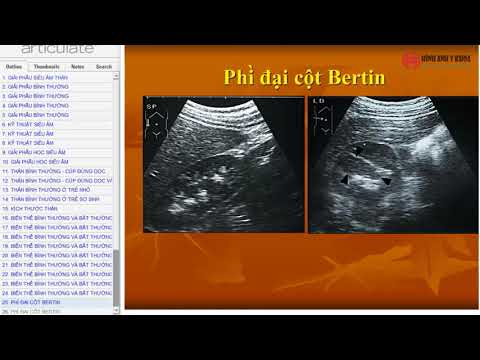Video 09. Giải phẫu siêu âm thận - BS Nguyễn Khôi Việt (SIÊU... - youtube