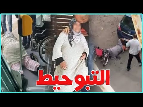 أحضي راسك من التبوحيط