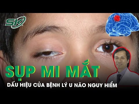 Video: Cách ghi điểm trong chơi gôn: 10 bước (có hình ảnh)